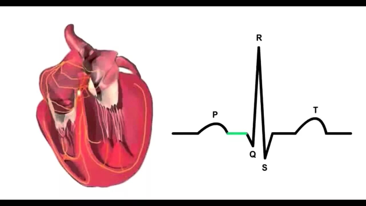 Аритмогенная кардиомиопатия на ЭКГ. Электрокардиограмма физиология зубцы. ЭКГ сердца. Сердечный цикл физиология. Миокард левого предсердия