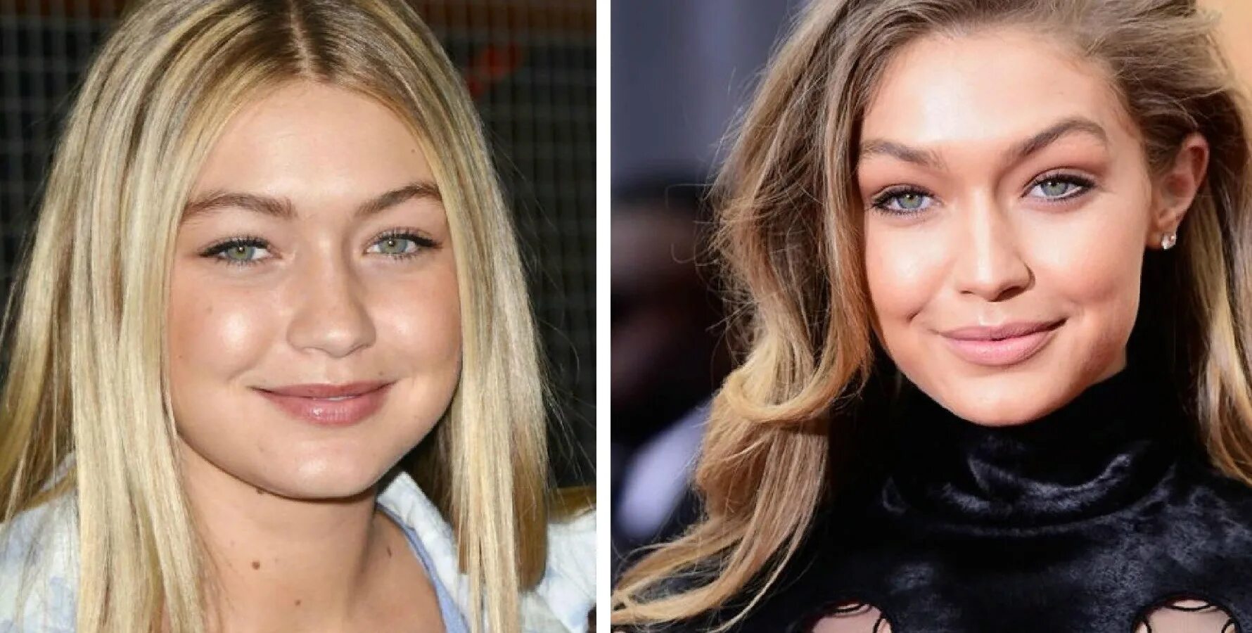 Gigi Hadid до пластики. Джи Джи Хадид до пластики. Джиджи Хадид до операции. Джиджихадид до и после пластики. Джиджи хадид сестры