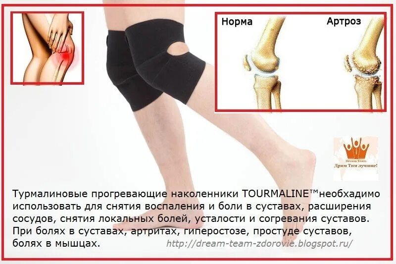 Размеры наколенников при артрозе коленного сустава