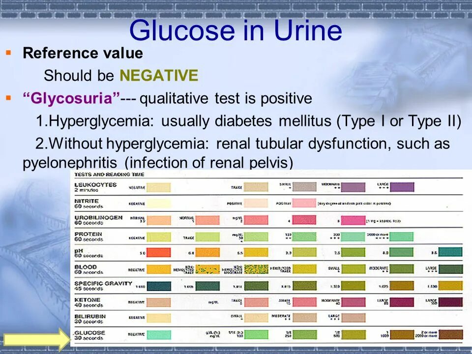Ссылки values. General urine analysis. normal urine analysis. glucose in urine test. urine analysis normal values.