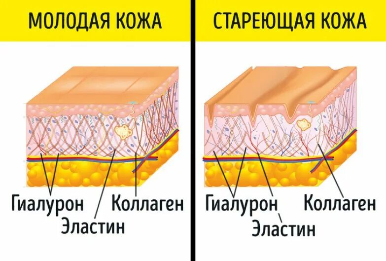 Изменение структуры кожи. Строение кожи коллаген эластин. коллаген и эластин в коже схема. строение дермы коллаген и эластин. коллаген кожи строение.