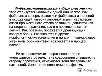 Фазы фиброзно кавернозного туберкулеза