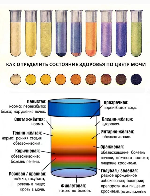 Цвет мача. Какого цвета моча у грудничка в 2. Изменение цвета мочи. Нормальный цвет мочи. Цвет мочи при патологии.