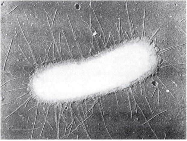 Микрофотография бактериальной клетки. Микрофотография клетки бактерии. Escherichia coli жгутики. Микрофотография бактериальной клетки. Кишечная палочка эшерихия коли.