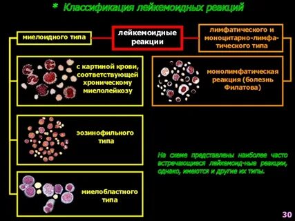 Миелолейкоз продолжительность жизни
