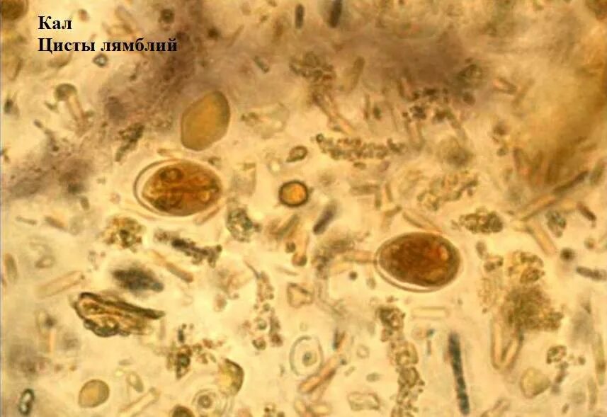 Споры в кале у взрослого. Цисты лямблии микроскопия. Микроскопия кала яйца гельминтов. Циста лямблии под микроскопом.