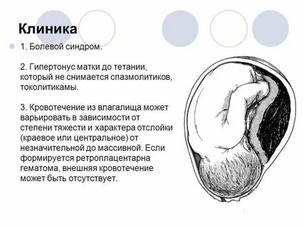 Небольшие выделения при беременности на ранних