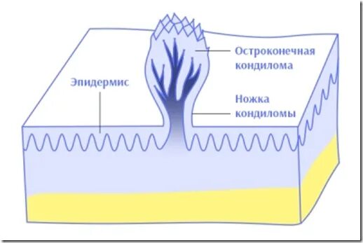 Слизистые покровы или гладкая поверхность мелкие. Аногенитальные бородавки (кондиломы). Остроконечные кондиломы строение. Остроконнчныемкондиломы.