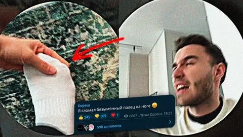 Сломал безымянный