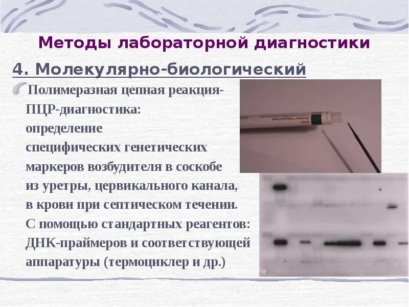 Пцр практическое применение. Пцр диагностика мочи. Расшифровка анализа пцр на инфекции. Пцр туберкулез. Пцр метод исследования микробиология.