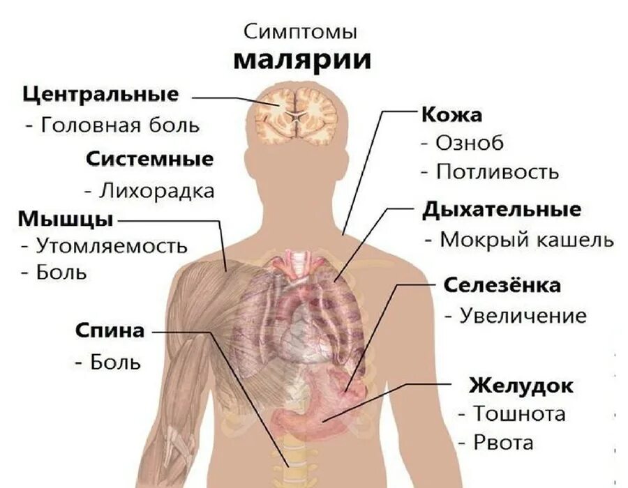 Почему для борьбы с малярией. Малярийный плазмодий заболевание. Малярийный плазмодий клинические проявления. Симптомы заражения малярией. Малярийный плазмодий признаки заболевания.