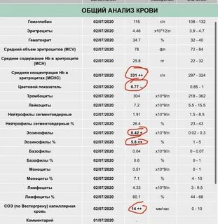 Общий анализ при кори