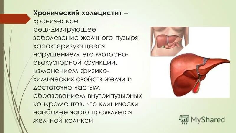 Болезни печени холецистит. Болезни печени холецистит. Хронический холецистит этиология. Книги про желчнокаменную болезнь. Катаральный холецистит.