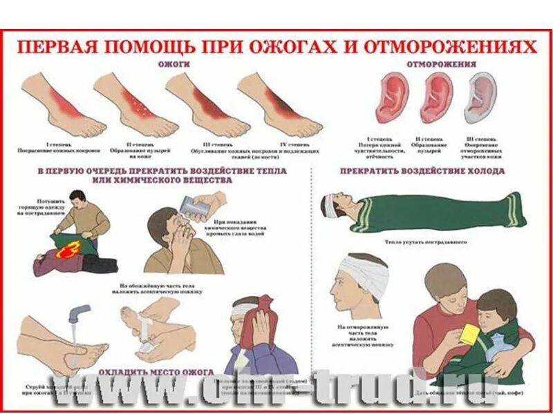 Оказание первой доврачебной медицинской помощи при ожогах. Оказание первой медицинской при ожогах и обморожении. Оказание 1 медицинской доврачебной помощи при ожогах. Алгоритм оказания первой помощи при ожогах и обморожениях. Средства первой помощи при ожогах