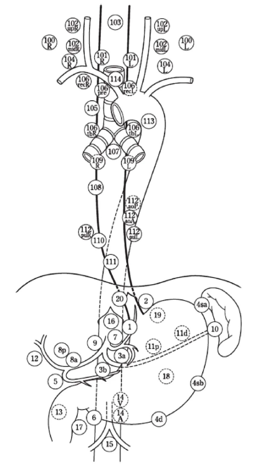 Лимфатические узлы брюшной полости японская классификация. Регионарные лимфоузлы брюшной полости. Японская классификация лимфатических узлов. Регионарные лимфатические узлы схема. Лимфоузлы пищевода