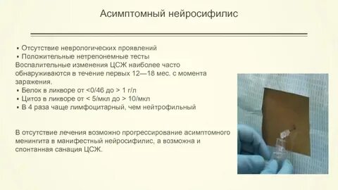 Что такое нейросифилис