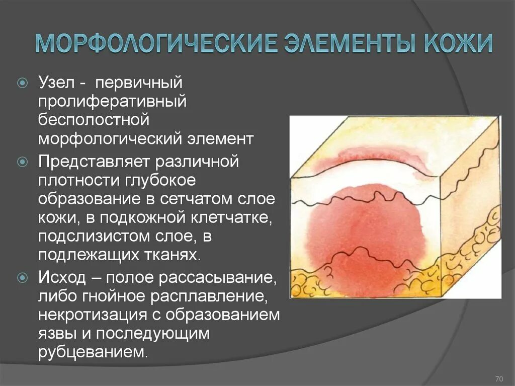 Вторичные элементы поражения