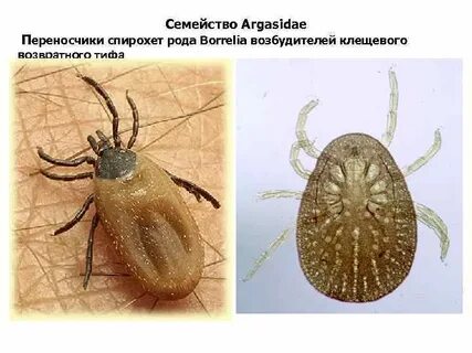 Клещевой сыпной тиф презентация