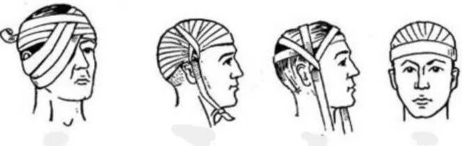 Повреждение затылка какая повязка. Десмургия повязки. Повязки на шею десмургия. Десмургия перевязка головы. Повязки на нижнюю конечность десмургия.