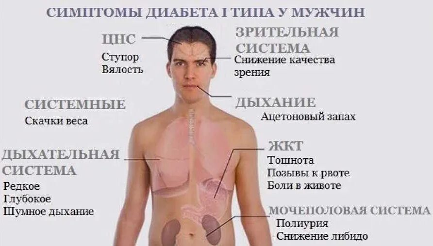 Симптомы, характерные для сахарного диабета:. Диабет 1 типа симптомы у мужчин первые признаки заболевания. Симптомы сахарного диабета у женщин. Проявление сахарного диабета. Проявления сахарного диабета у мужчин.
