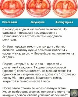 Почему начинает першить горло