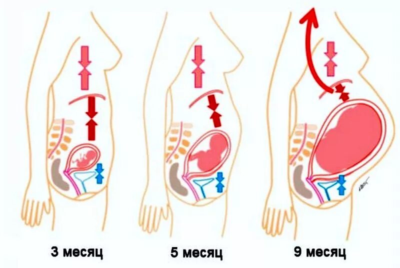 Почему при беременности сильно. Органы при беременности в 3 триместре. Изжога при беременности. Расположение органов у беременных. Расположение органов у беременной женщины 3 триместр.