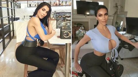 Жертвы красоты: модели и актеры, ушедшие из жизни из-за увлечения пластикой...