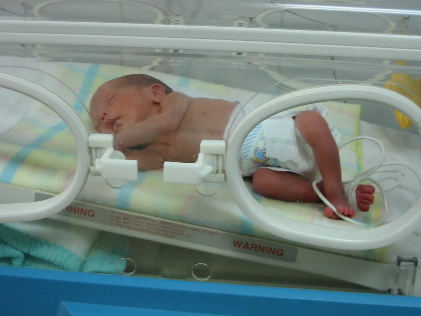 Новорождённые дети недоношенные. Новорожденные недоношенные в кювезах. Семимесячный ребенок родился. Новорождённый в кувейзе?.