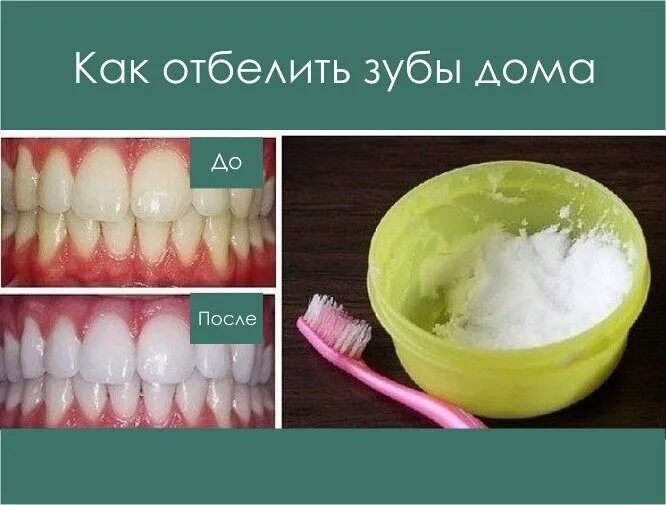 Как отбелить зубы рецепт. Как отбелить зубы в домашних условиях.