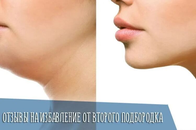 Подъязычная мышца и второй подбородок. Второй подбородок у худых. Слабо развитый подбородок. Скошенный подбородок. Причины второго подбородка у мужчин.