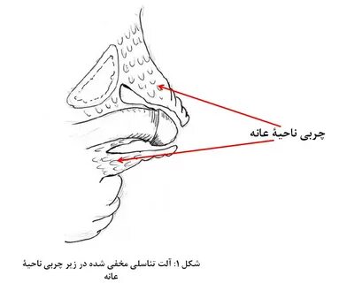 Penile lenghthening fig 1 