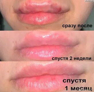 Стеллаж для губ