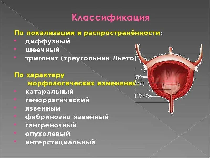 Мочепузырный треугольник Льето. Треугольник Льето мочевого пузыря. Строение треугольника мочевого пузыря. Треугольник мочевого пузыря анатомия. Диффузный мочевой пузырь