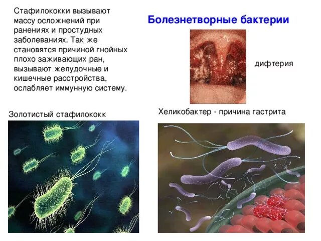 Пример бактерий вызывающих болезни. Бактерии и болезни 5 класс. Болезнетворные бактерии. Болезнетворные бактерии человека. Сообщение о болезнетворных бактериях.