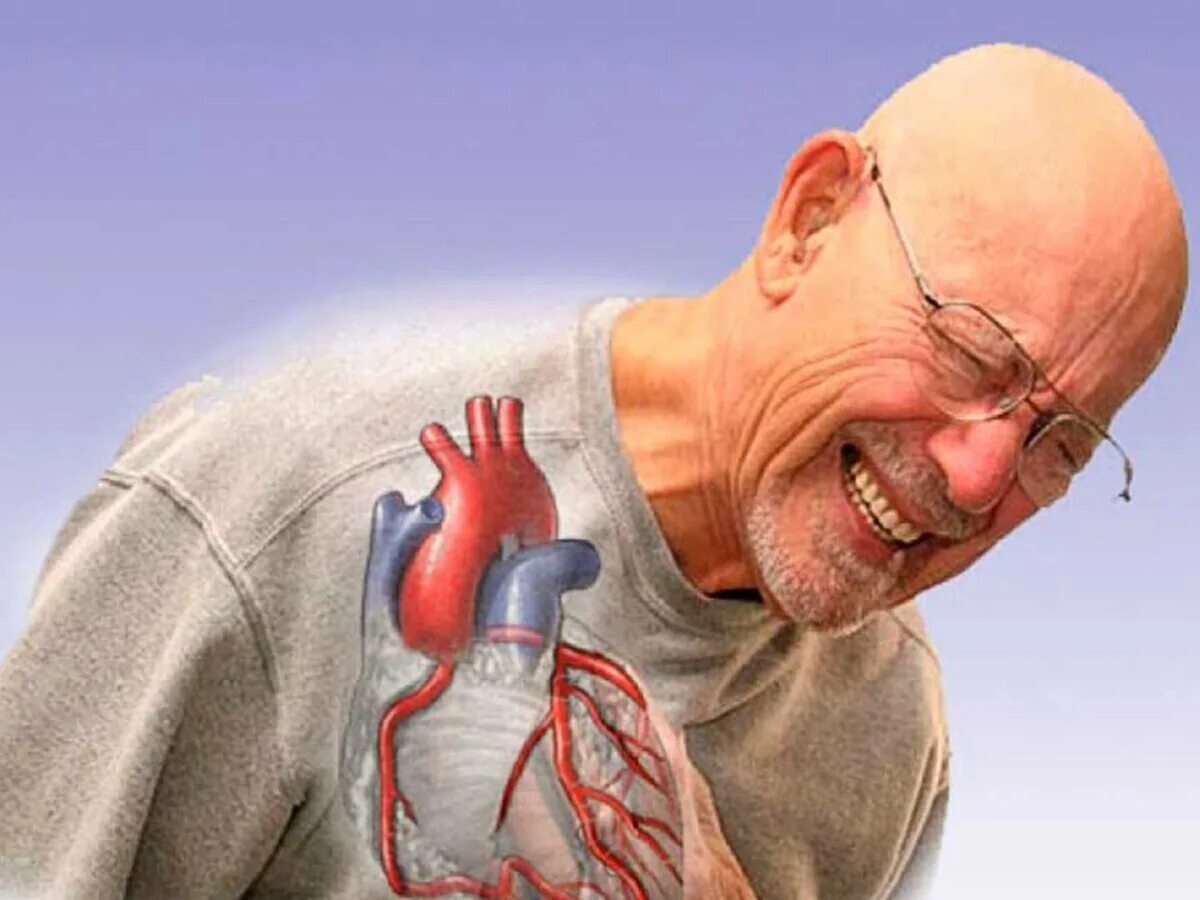 Ишемия симптомы у мужчин. Стенокардия ишемия сердца. ИБС стенокардия атеросклероз симптомы. Ишемические поражения сердца.