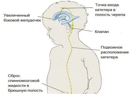 Как проверить черепное