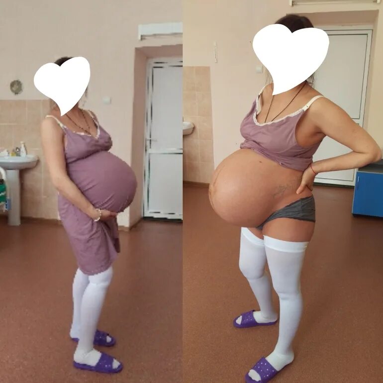 Животы беременных двойней. Роды 36 беременность форум