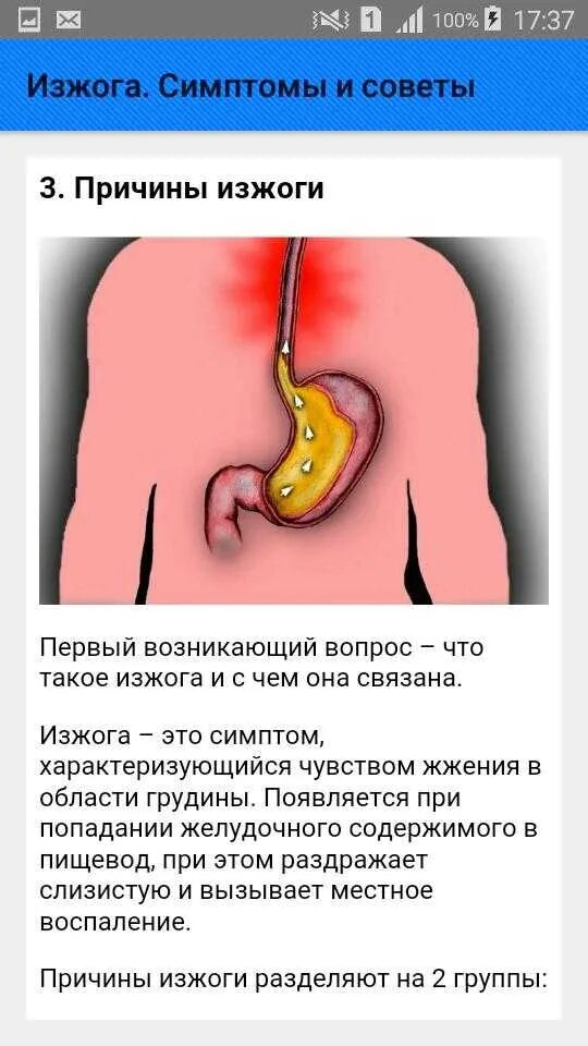 Почему часто изжога. Симптомы изжоги симптомы.