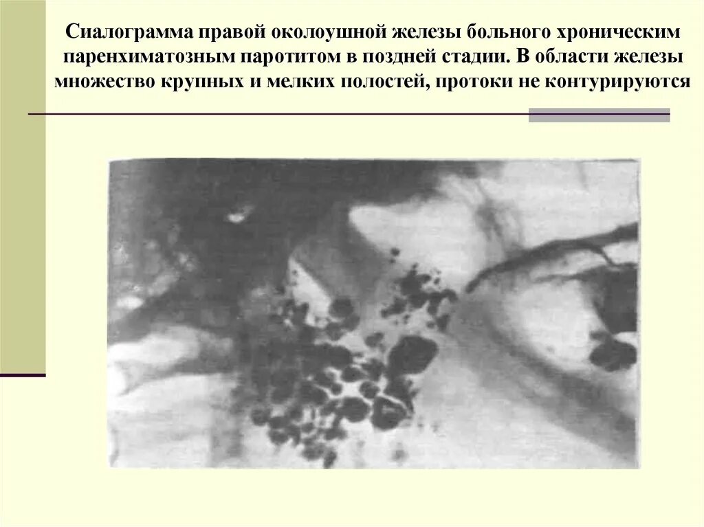 Сиалодохит