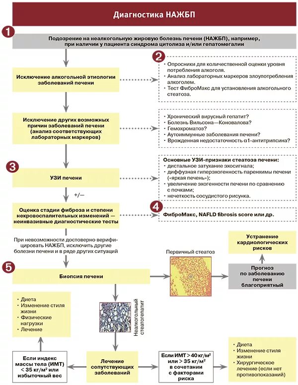 Схема лечения жирового гепатоза печени лекарствами. Неалкогольная жировая болезнь печени (НАЖБП). Схема лечения гепатоза печени лекарствами. Дистрофии печени схема. Лечение фиброза печени 3