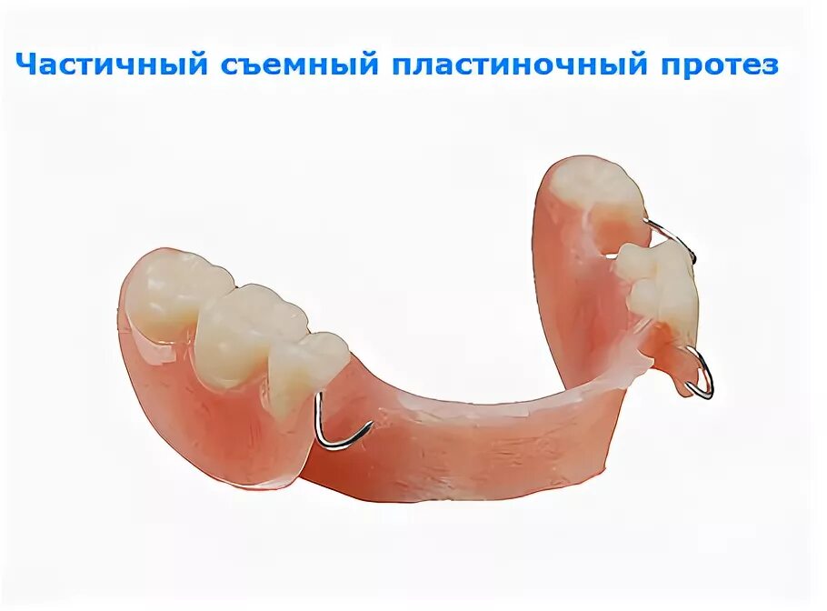 Конструкция частичных съемных протезов