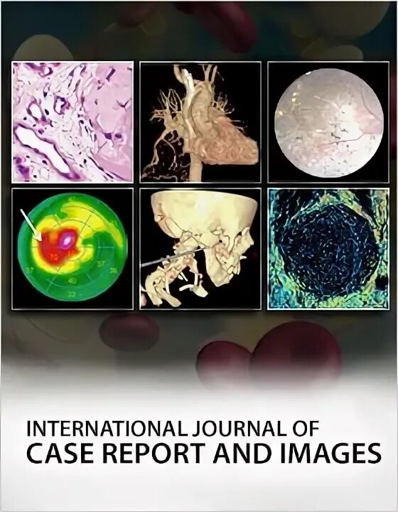 Case report journals. Case report journals