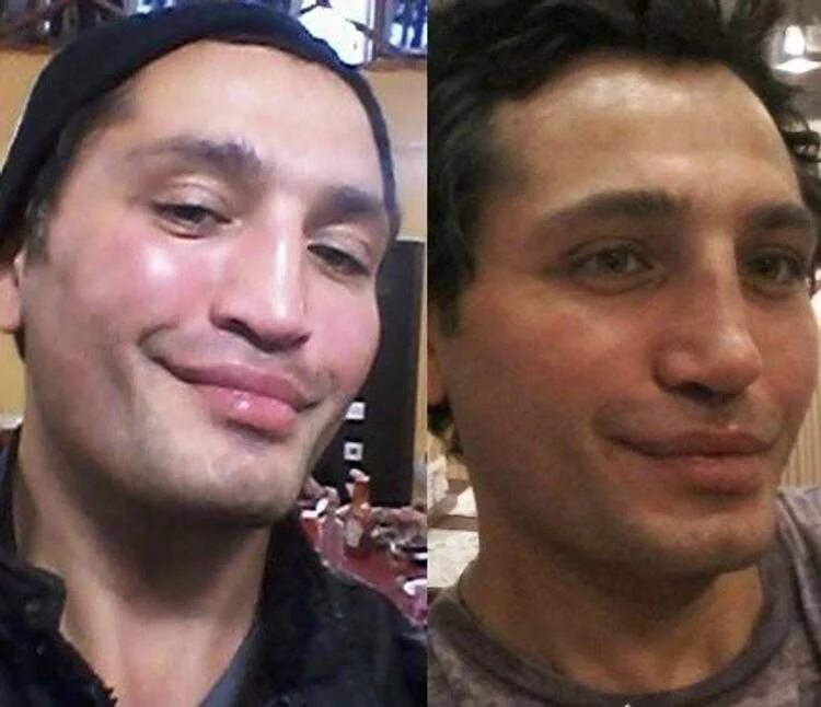 Какую операцию делал давай