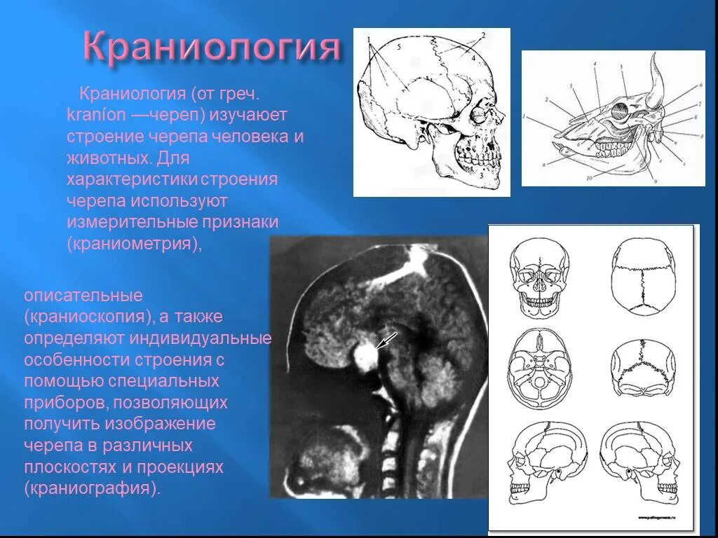 Понятие о краниометрии. Краниология. Комплекс научных дисциплин. Краниологические признаки. Череп динарской расы.