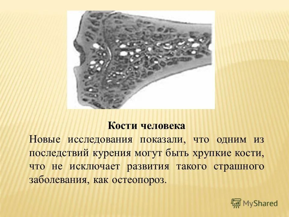 отсутствие кальция в костях. кальций в костях человека. самая прочная кость в теле человека. сасамая прочная костю у человека. самая хрупкая кость.