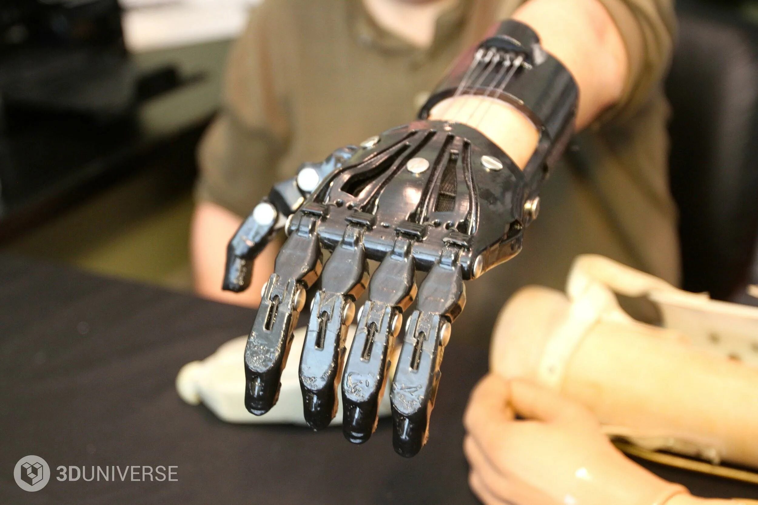 Bebionic протезы. Тяговые протезы Киби. Бионический протез кисти руки. Бионические протезы верхних конечностей.
