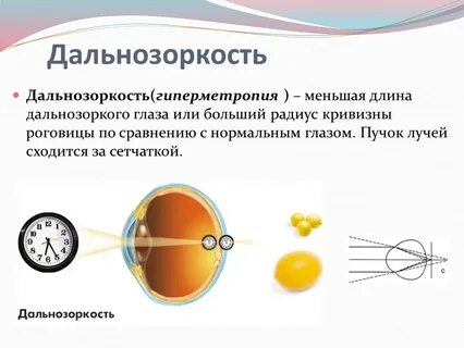 Близорукость и дальнозоркость разница простым языком
