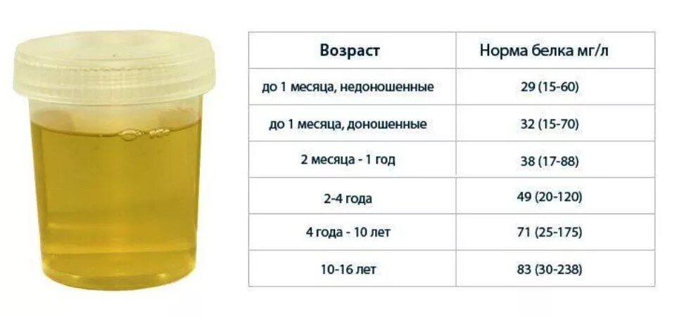 Сколько мочи за один раз. Норма белка в моче у ребенка 5 месяцев. Норма белка в моче у ребенка 4 месяца. Белок в моче норма у детей 14 лет. Белок в моче у ребенка 1,5 лет норма.