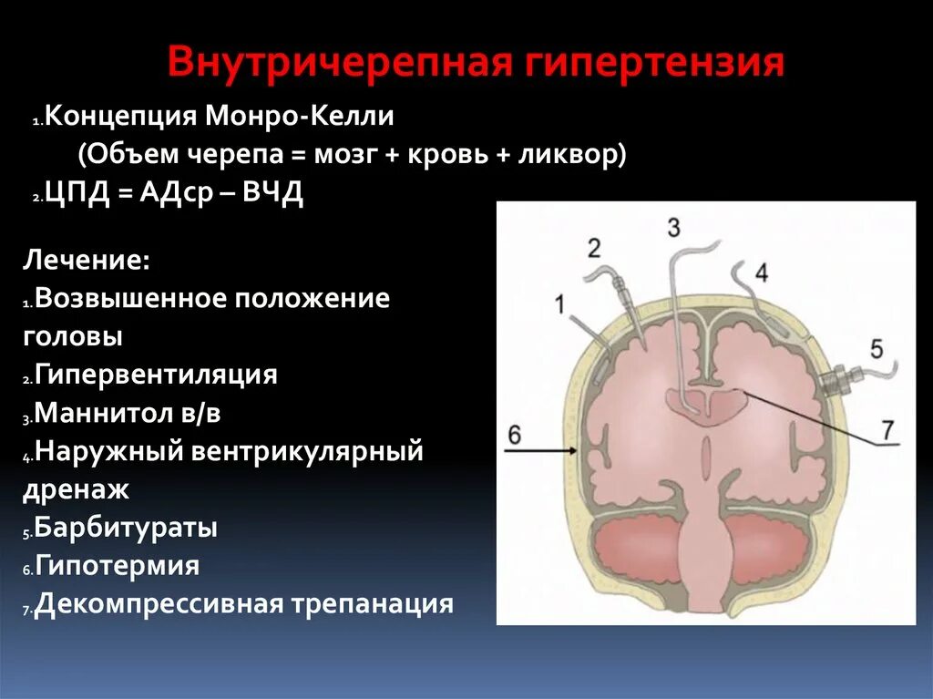 Внутричерепная гипертензия. Синдром внутричерепной гипертензии. Внутренне черепная гипертензия. Идиопатическая внутричерепная гипертензия.