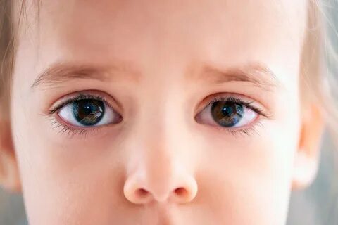 Eye 1